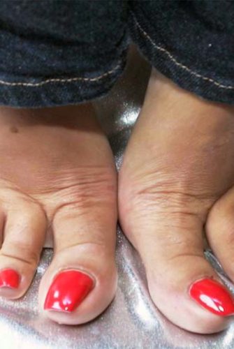 Tammy’s Big Toenails